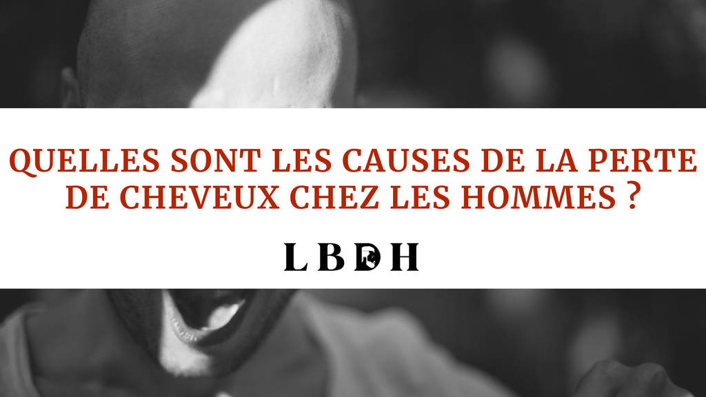 Quelles sont les causes de la perte de cheveux chez les hommes ?