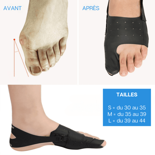 CORRECTEUR HALLUX VALGUS